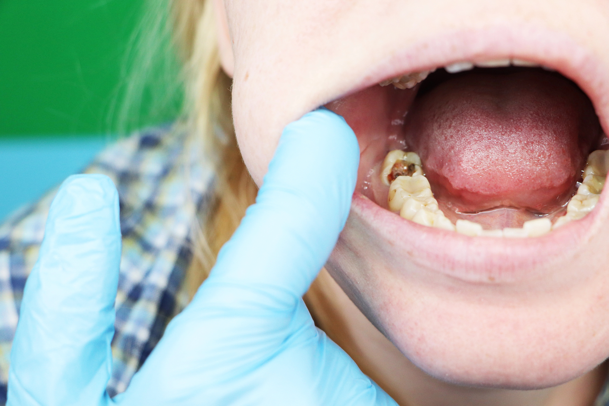 Izreden napredek, ki ga je endodontija dosegla s pomočjo moderne tehnologije